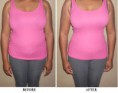 /album/fotogaleria/beforeafter-body-magic-edited-jpg/